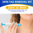 ALIVER 2in1 Gentle Skin Tag Removal Kit